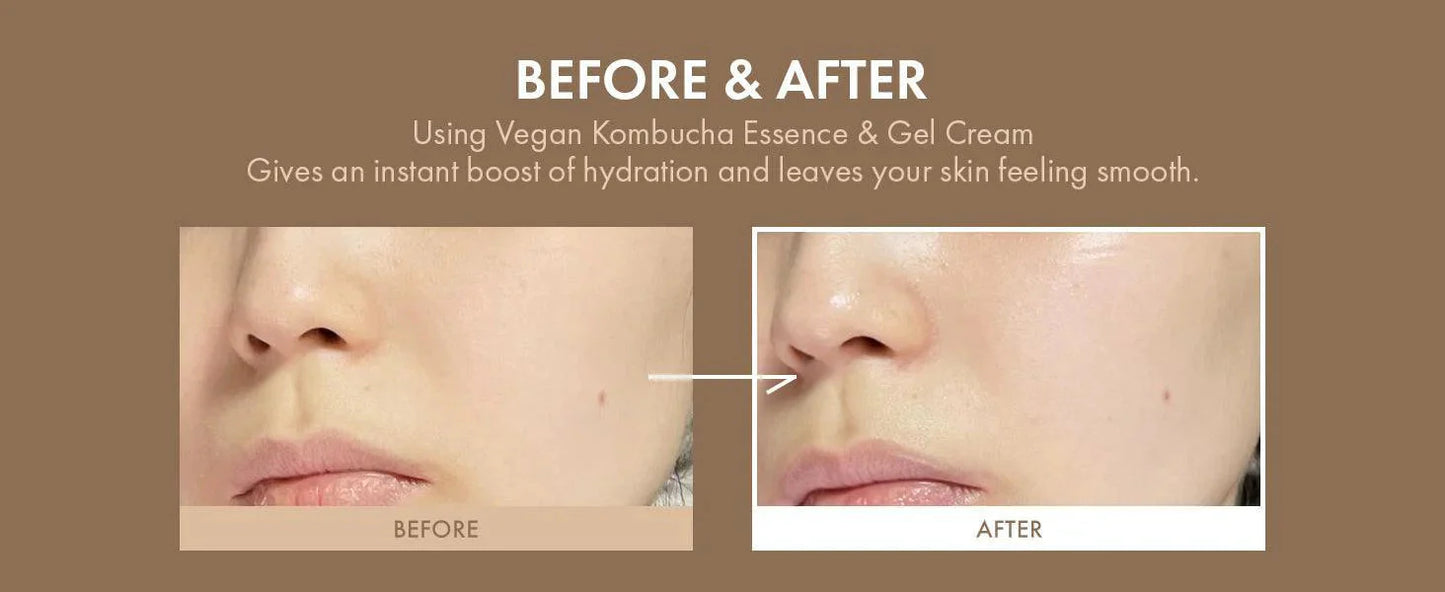 Dr.Ceuracle VEGAN KOMBUCHA TEA ESSENCE