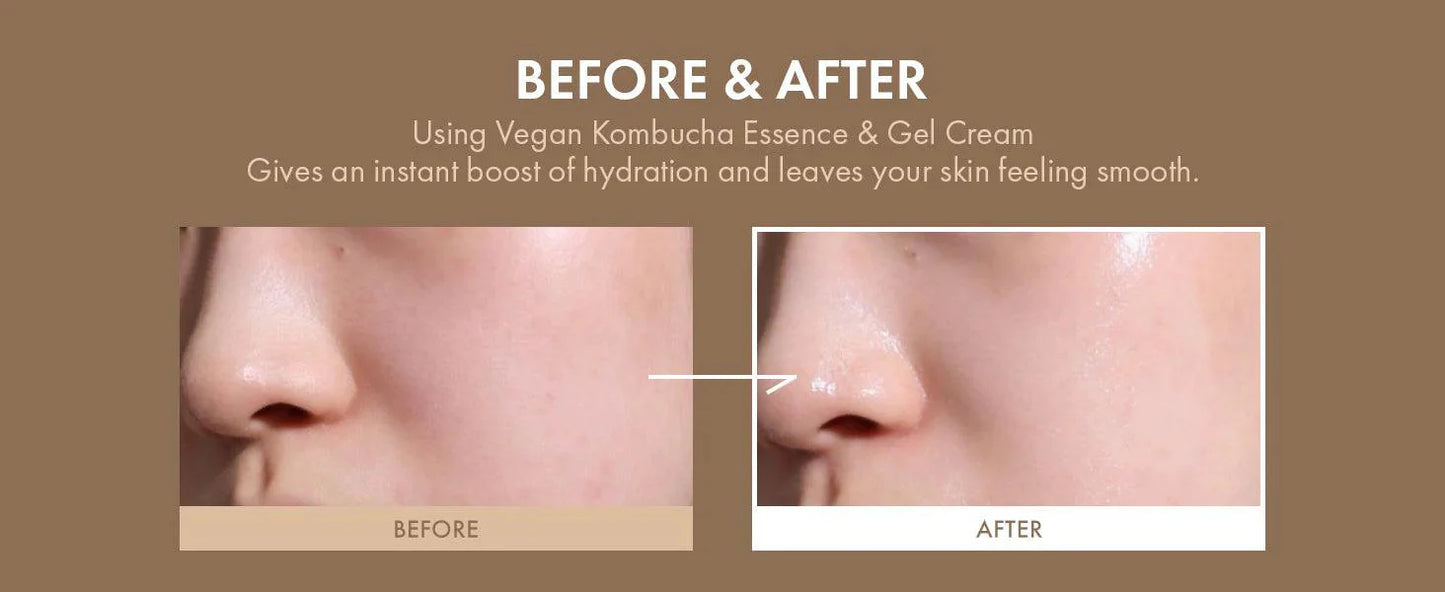 Dr.Ceuracle VEGAN KOMBUCHA TEA GEL CREAM