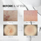 VT COSMETICS VT REEDLE SHOT 300